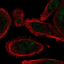 cysteine/histidine-rich 1 Antibody, Novus Biologicals 0.1mL; Unlabeled:Antibodies,